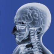 Neurotraumatologie Update Meeting