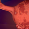 1st Vienna Interdisciplinary Endometriosis Masterclass