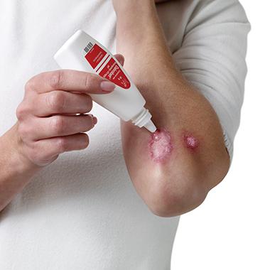 Daivobet® Gel
