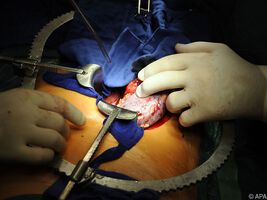 Nierenerkrankungen werden unterschätzt