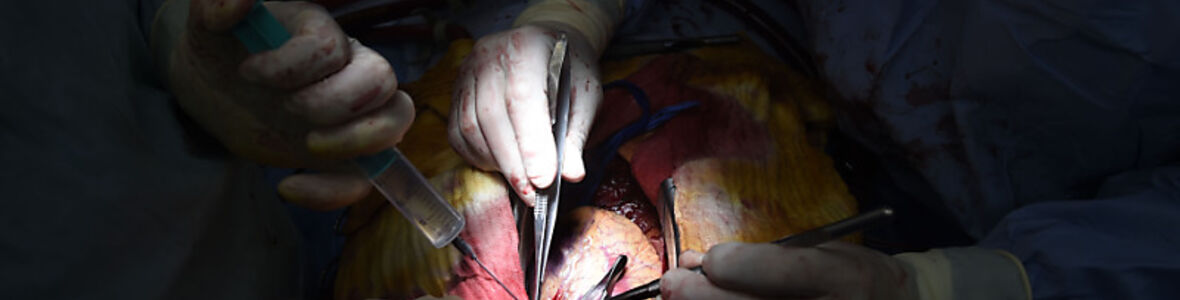 Bypass bei schwerer koronarer Herzkrankheit einem Stent vorzuziehen