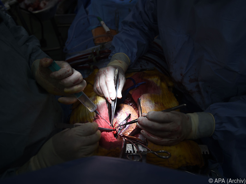 Bypass bei schwerer koronarer Herzkrankheit einem Stent vorzuziehen