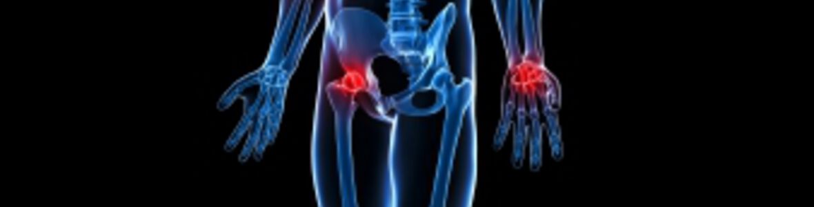 Rheuma – Symptome, Ursachen und Diagnose