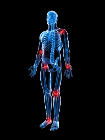 Rheuma – Symptome, Ursachen und Diagnose