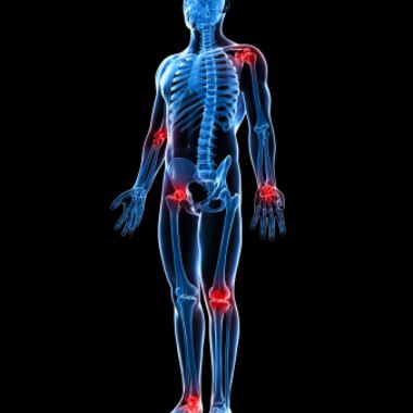 Rheuma – Symptome, Ursachen und Diagnose