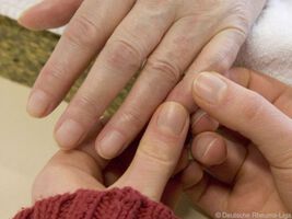 Rheuma – Therapie und allgemeine Tipps