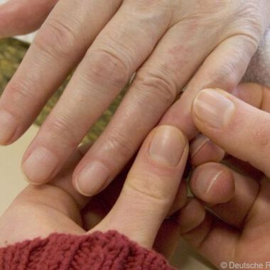 Rheuma – Therapie und allgemeine Tipps