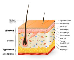 Epidermolysis bullosa – eine folgeschwere und unheilbare Hauterkrankung