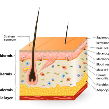 Epidermolysis bullosa – eine folgeschwere und unheilbare Hauterkrankung