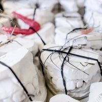 Zahnärztliche Chirurgie - wie geht die rasche und entzündungsfreie Einheilung?