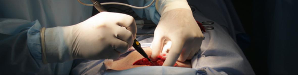 Europäischer Orthopädie-Kongress in Wien: Postoperative Wundinfektionen bereiten Sorge