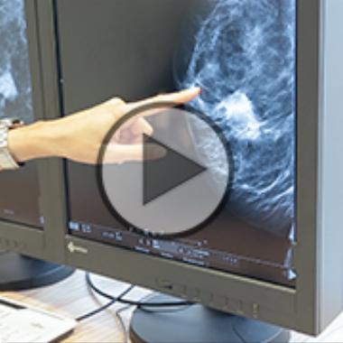 Sind Knoten in der Brust gefährlich? (Video)