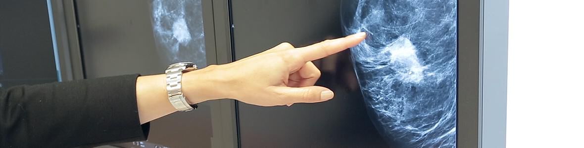 Sind Knoten in der Brust gefährlich? (Video)