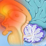 Parkinson Impfung- Innovativer Ansatz und noch ein weiter Weg bis zur Marktreife
