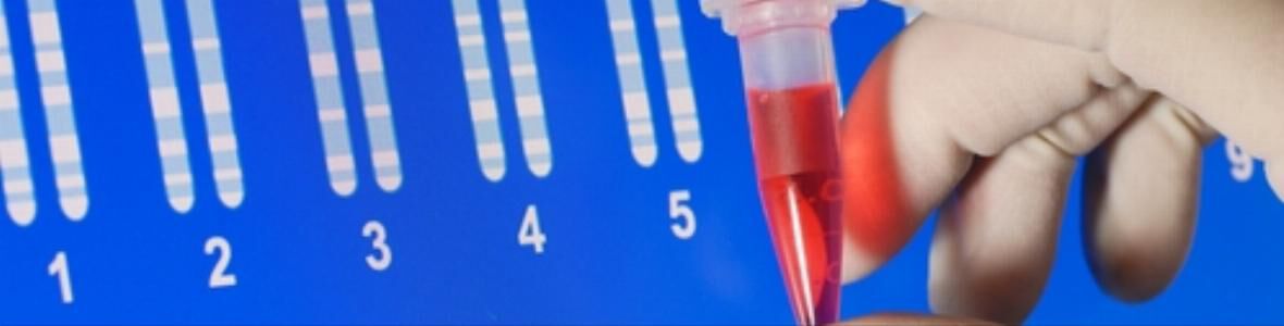 Neu entdeckte Mutation führt zu schwerer Darmerkrankung