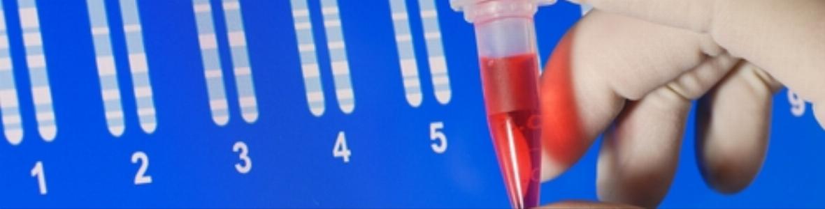 Neu entdeckte Mutation führt zu schwerer Darmerkrankung