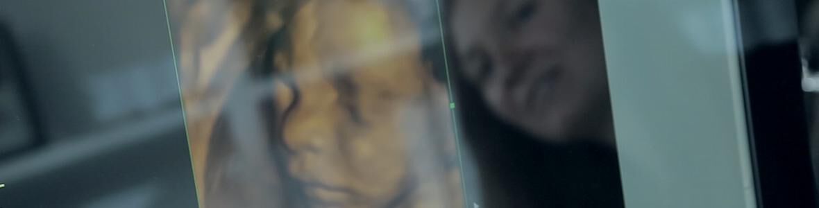 Pränataldiagnostik (Video)