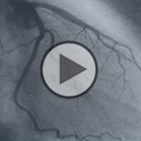 Die Physikalische Gefäßtherapie: Dr. Armin Diermeier zum Thema - Video