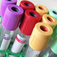 Hepatitis: immer noch hohe Dunkelziffer