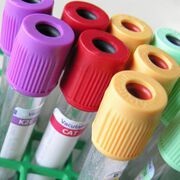 Hepatitis: immer noch hohe Dunkelziffer
