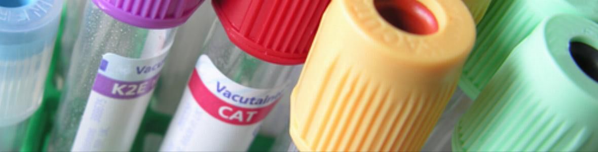 Hepatitis: immer noch hohe Dunkelziffer