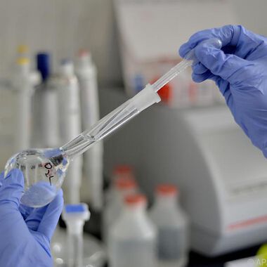 Reset-Taste: Manipulation gegen heftige Reaktion des Immunsystems