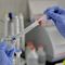 Reset-Taste: Manipulation gegen heftige Reaktion des Immunsystems
