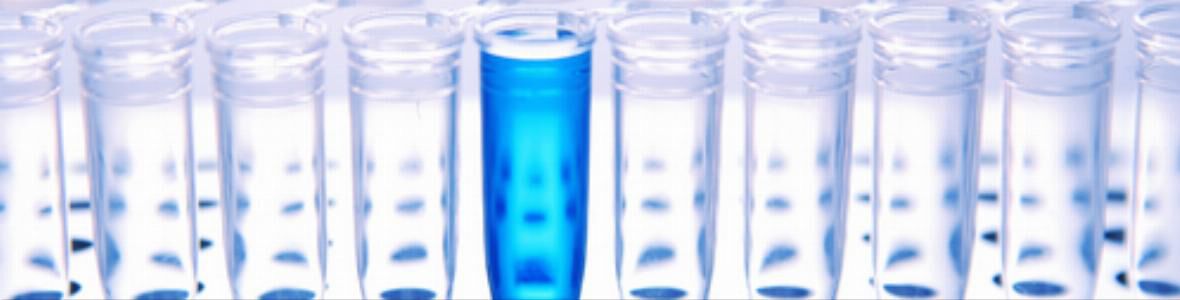 Höchstrisikopatienten: Körpereigener Biomarker proBNP gibt Hinweis auf Sterberisiko