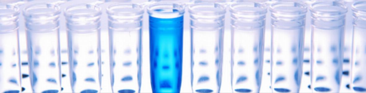 Höchstrisikopatienten: Körpereigener Biomarker proBNP gibt Hinweis auf Sterberisiko