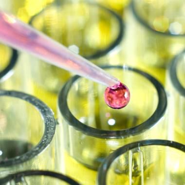 Leberkrebs: Zürcher Forscher entdecken Auslöser