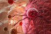 Krebs: Lymphgefäße unterstützen die Therapie