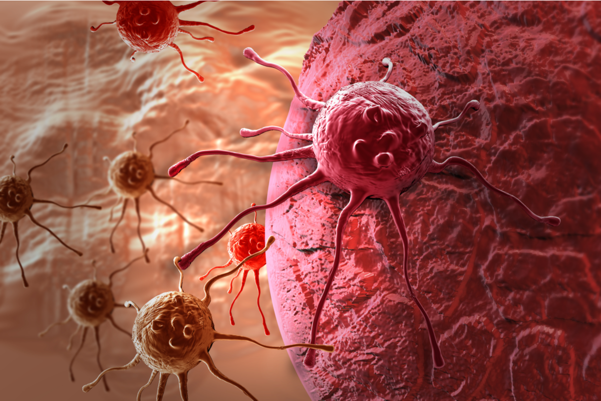 Krebs: Lymphgefäße unterstützen die Therapie