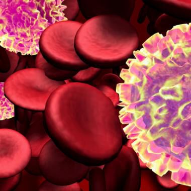 Individualisierte Blutkrebstherapie deutet auf positive Effekte hin