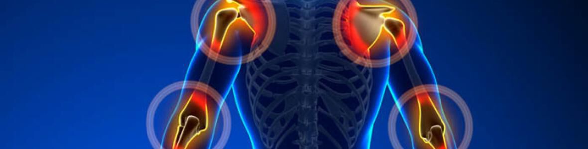 Neues aus der Rheumatologie