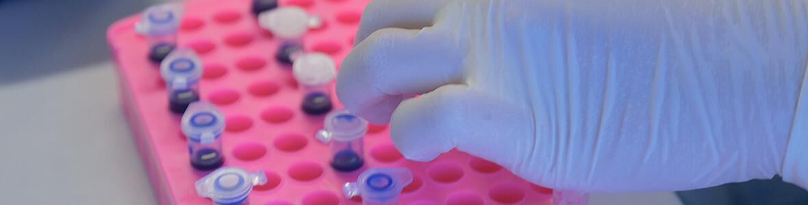 Bluttest für Brustkrebsdiagnostik - Video