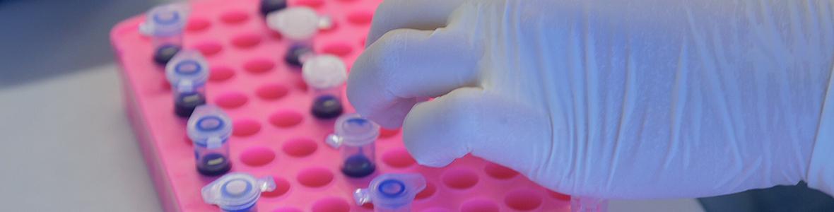 Bluttest für Brustkrebsdiagnostik - Video