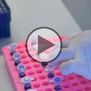 Bluttest für Brustkrebsdiagnostik - Video