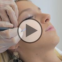 Tipps vom Profi gegen Hautalterung - Video
