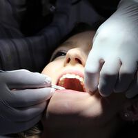 Hypnose beim Zahnarzt kann die Angst verhindern
