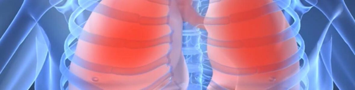 Zystische Fibrose: Forscher der Uni Zürich sind Heilung auf der Spur