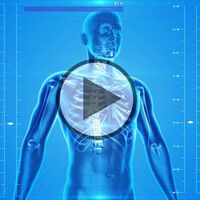 Osteoporose - Video