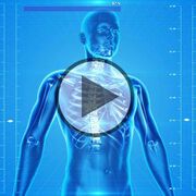 Osteoporose - Video