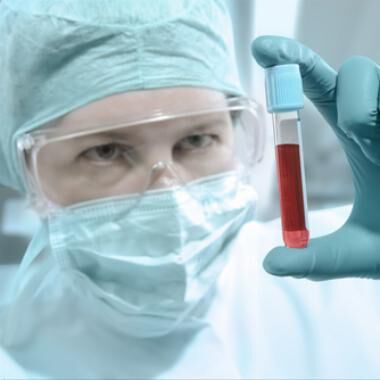 Krebsforschung: neue Biomarker sagen Erfolg von Immuntherapie vorher