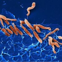 Helicobacter pylori-Infektionen verändern das Magenmilieu nachhaltig