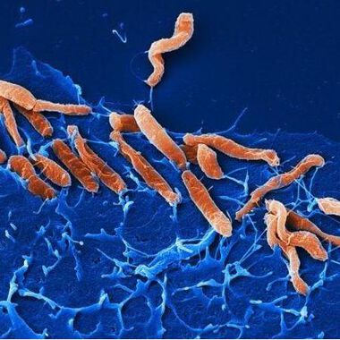 Helicobacter pylori-Infektionen verändern das Magenmilieu nachhaltig