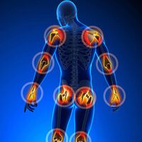 Rheumatag Tirol am 21. Februar in Innsbruck
