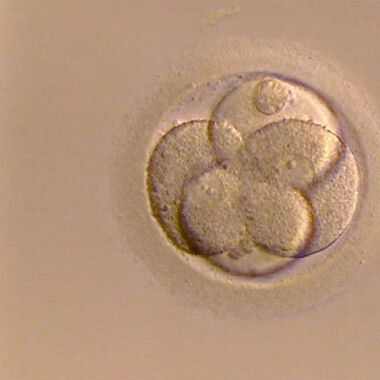 Forscher züchten erstmals menschliche Eizellen im Labor