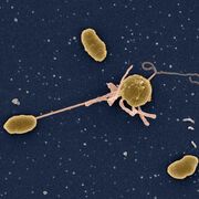 Cholera: Wie Bakterien im Darm überleben