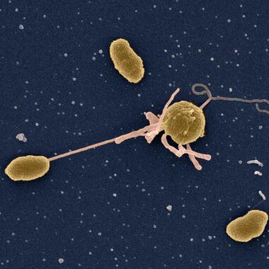 Cholera: Wie Bakterien im Darm überleben