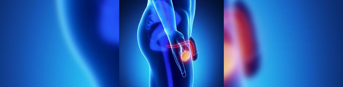 Gutartige Prostatavergrößerung - Video